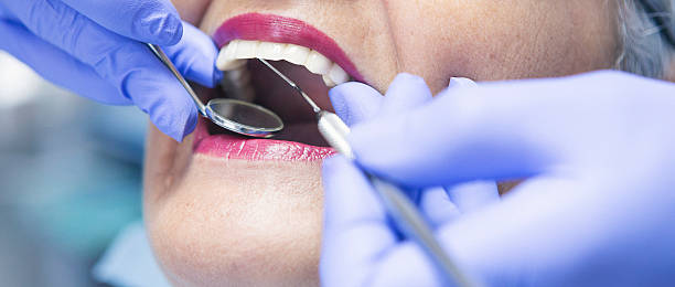 Best Emergency Treatment for Dental Infections or Abscesses in Milroy, PA